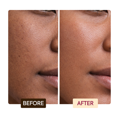 Brightening Exfoliating Antiseptic Soap - Image 6