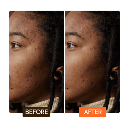 Extreme Argan & Carrot Oil Dark Spot Corrector Serum - Image 6
